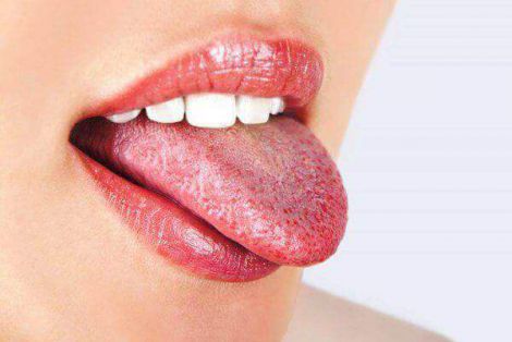 Причини пожовтіння язика