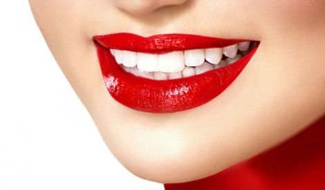 Що треба знати про відбілювання зубів?