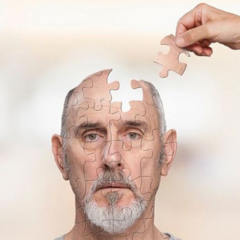 Вчені: хвороба Альцгеймера "смажить" ваш мозок