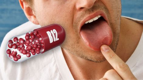 На дефіцит вітаміну B12 вкаже незвичайний стан язика