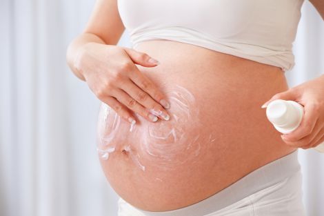 Розтяжки можуть виникати під час вагітності