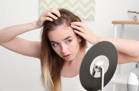 Зловживання вітамінами призводить до випадіння волосся