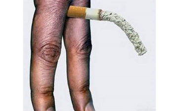Чоловіки, які кинули палити, володіють значно більшим розміром збудженого пеніса