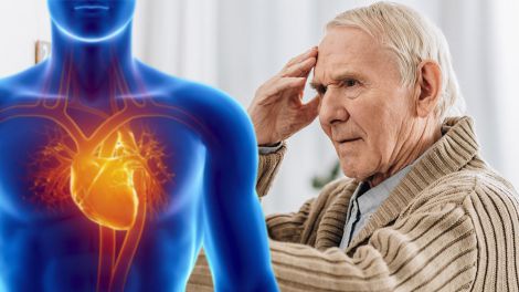 Вчені з'ясували, яка хвороба серця підвищує ризик деменції на 35%