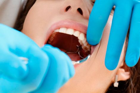 Як відбувається процес видалення зубів мудрості?
