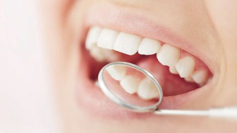 Очищають емаль: список корисних для зубів продуктів