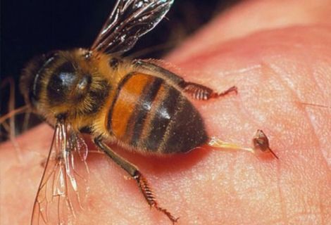 Допомога при укусі бджоли