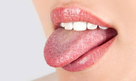 Почервоніння язика