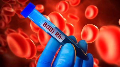 Яка група крові підвищує ризик розвитку небезпечних захворювань, з'ясували вчені