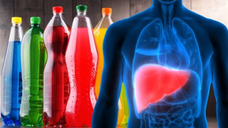 Солодкі напої: чим вони можуть бути небезпечні для печінки
