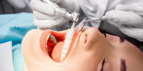 Небезпека відмови від професійної чистки зубів