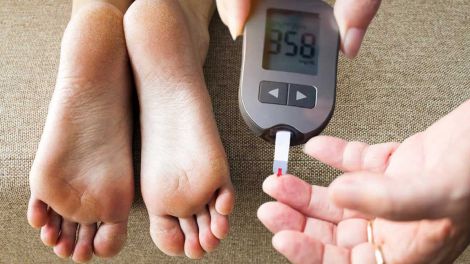 Стан шкіри ніг може вказувати на діабет другого типу