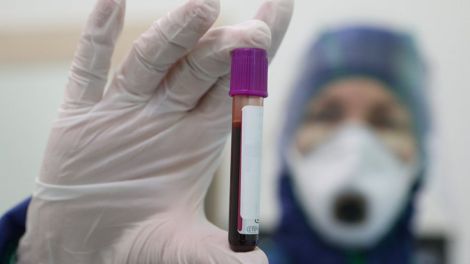 Вчені з'ясували зв'язок між групою крові і захворюваннями