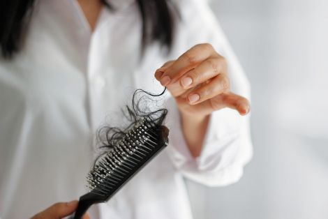 Генетика випадіння волосся
