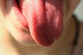 Розпухлий язик
