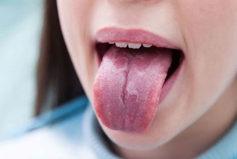 Вигляд язика та стан здоров'я