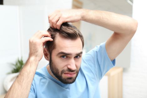 5 порад для зменшення випадіння волосся у чоловіків 