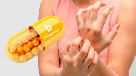 Дефіцит вітаміну D: дві основні ознаки на шкірі