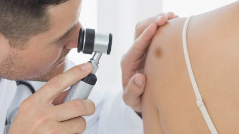 Рак шкіри: як знизити ризик захворювання розповів експерт