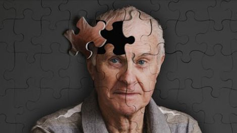 Загроза мозку: названий фактор, що підвищує на 73% ризик розвитку деменції