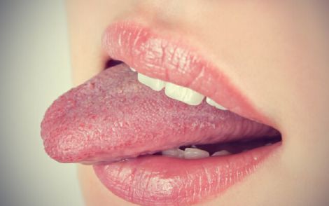 Стан язика та хвороби
