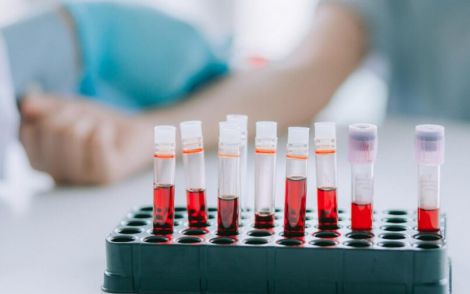 Аналіз крові для діагностики раку