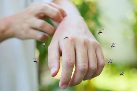 Допомога при укусах комарів