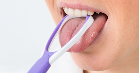 Чому треба частіше чистити язик?