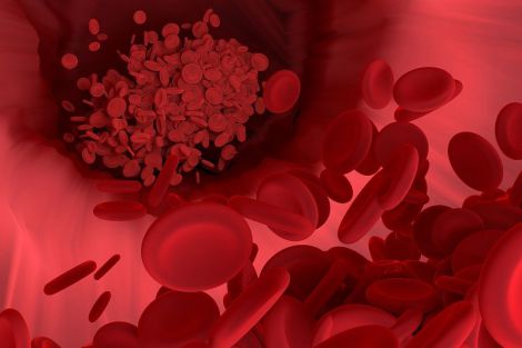 Десять ефективних препаратів для розрідження крові