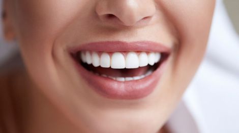 Завдяки яким продуктам ваші зуби стануть білішими