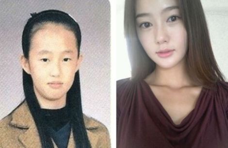 before_and_after_photos_of_korean_plastic_surgery_019.jpg (21.55 Kb)