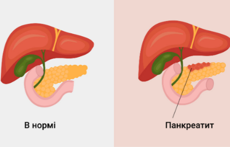 ������� �������� �������� �����������