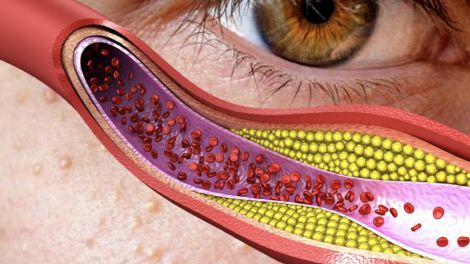 ��� ������� ������� ��������� �����������