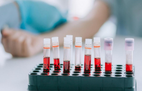 �� ������� �������� ������� ��������� ����� ����