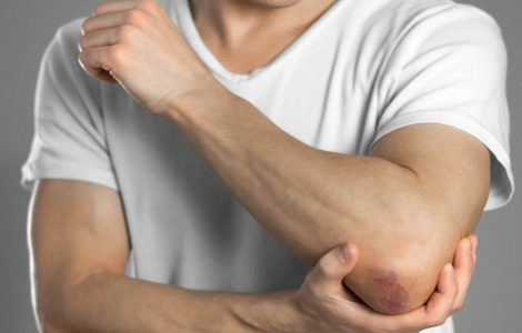 Основні помилки при лікуванні забоїв Основні помилки при лікуванні забоїв