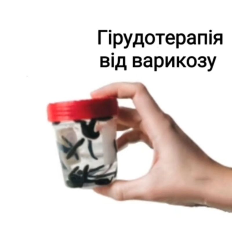 Гірудотерапія при варикозі та тромбофлебіті: лікарський підхід у «Лічниці сестер Похмурських»
