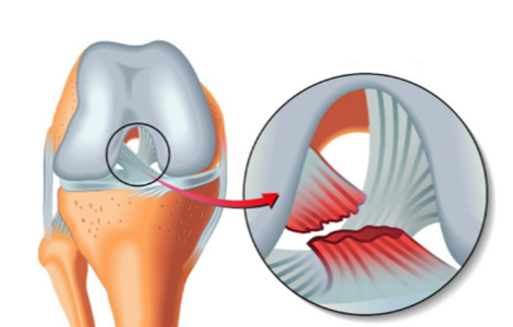 ���� ����� ���������� �� ����� ���� ������ �� ������