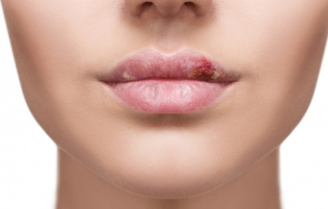 �� ������ ����� �������� ��� ������