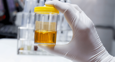 �� ������ ������������ �������� ������� ����������� �������?