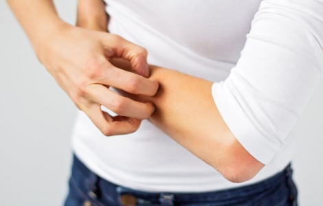 Шляхи зараження коростою і методи її лікування Шляхи зараження коростою і методи її лікування