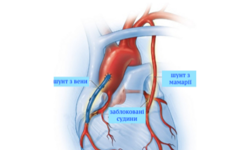 �� ��������� ������� ���������� �������