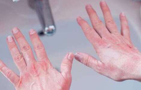 ���� ����� � ������� ��������� ���� �� ���� ����������� ���������