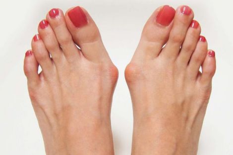 Взуття, котре збереже здоров'я ваших стоп Взуття, котре збереже здоров'я ваших стоп