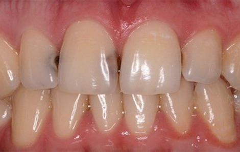 �� ����, ���� ����� �� ������� ����