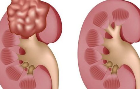 ������ ��� ���������� ������'� ����� � ������� ���� ����