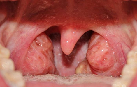 ���� ������ ��������� ������� � ��� �� �������