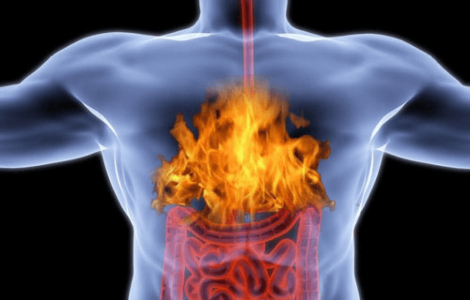 Чому в людини виникає печія Чому в людини виникає печія