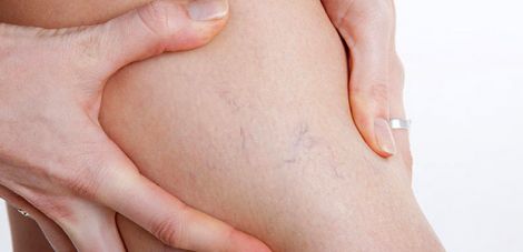 �� ����������� ���� ���������� ��������� ���������� ���