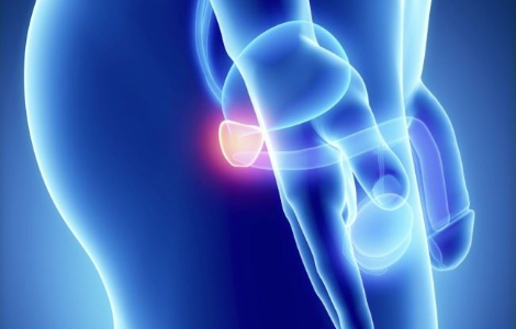 Як можна виявити рак простати на ранній стадії Як можна виявити рак простати на ранній стадії