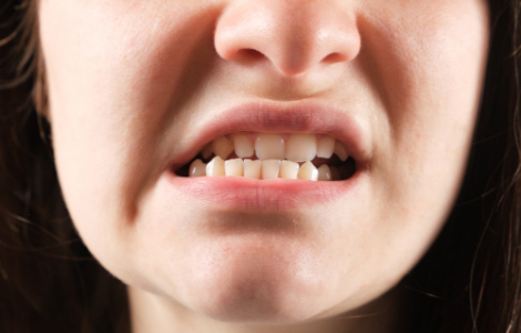 ��� ������� ������� ������������� �������